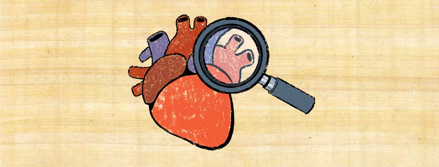 Anatomical heart with magnifying glass inspecting for heart conditions.