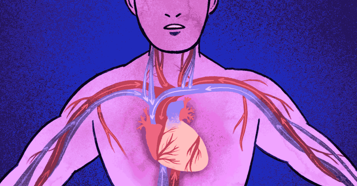Understanding the Types of Coronary Artery Lesions image